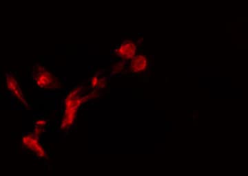 Polyclonal Rabbit anti-Human EIF4EBP1 / 4EBP1 Antibody (IHC, IF, WB)