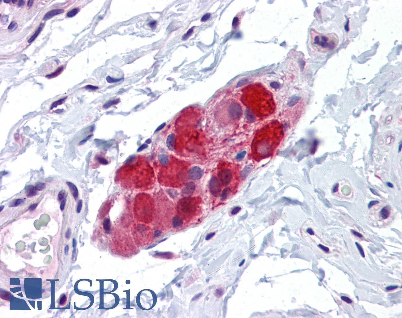 IHC-plus™ VRL1 / TRPV2 Antibody