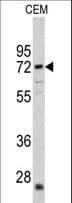 CRAT Antibody (aa66-96)