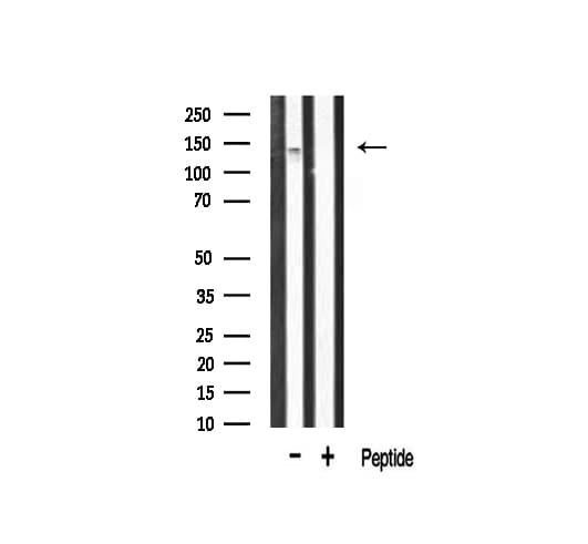 FGFR1 / FGF Receptor 1 Antibody (phospho-Tyr766)