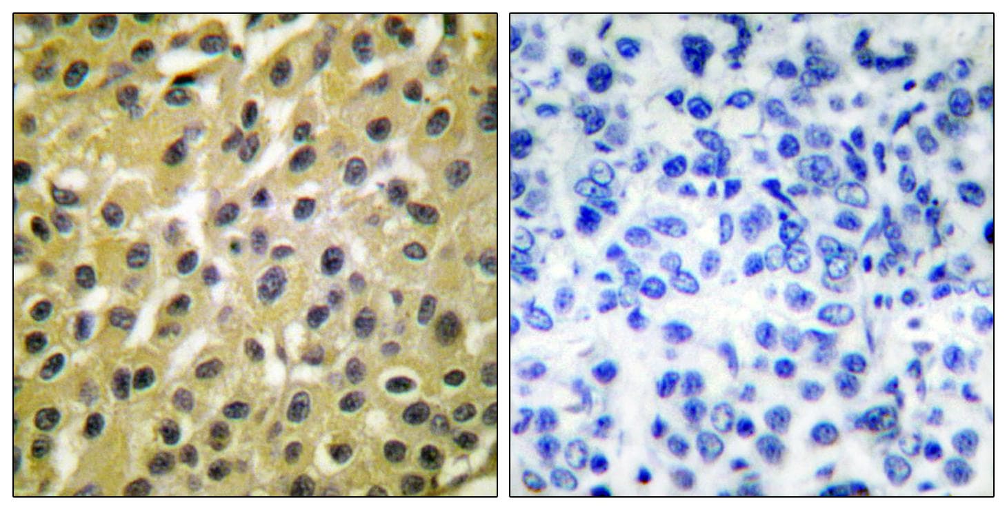 MDM2 Antibody