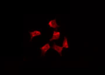 Polyclonal Rabbit anti-Human EZR / Ezrin Antibody (phospho-Tyr353, IF, WB)