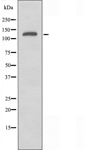 RGAG1 Antibody