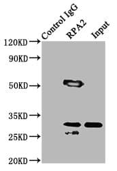 IHC-plus™ Polyclonal Rabbit anti-Human RPA2 / RFA2 / RPA34 Antibody (IHC, WB)
