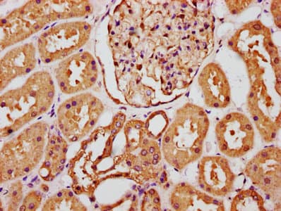 Polyclonal Rabbit anti-Human FGF1 / Acidic FGF Antibody (aa16-155, IHC)