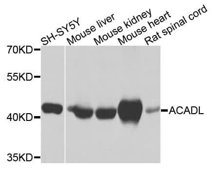 ACADL Antibody