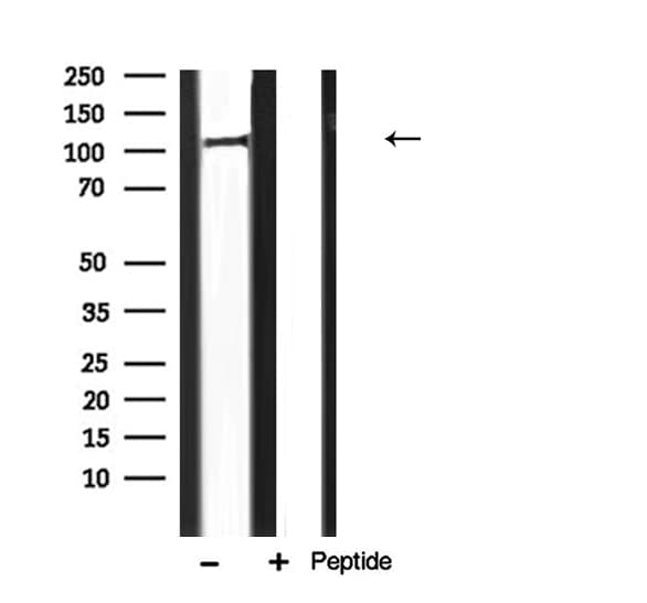 EIF2AK3 / PERK Antibody
