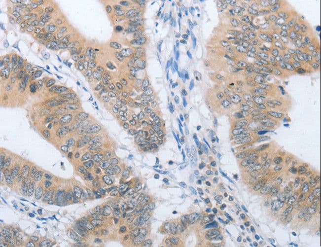 Polyclonal Rabbit anti-Human CHRNA10 Antibody (IHC)