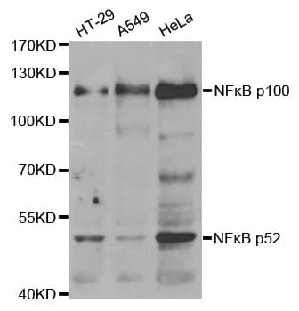 NFKB2 Antibody