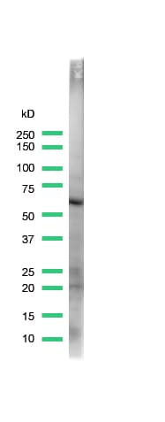 Polyclonal Rabbit anti-Human OCLN / Occludin Antibody (C-Terminus, IHC, WB)