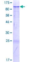 Human NACC2 / BTBD14A Protein (Recombinant GST)