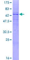 Human AGPAT4 Protein (Recombinant GST)