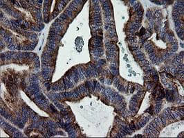 ERBB2 / HER2 Antibody (aa676-1255, clone OTI4F6, Carrier-free)