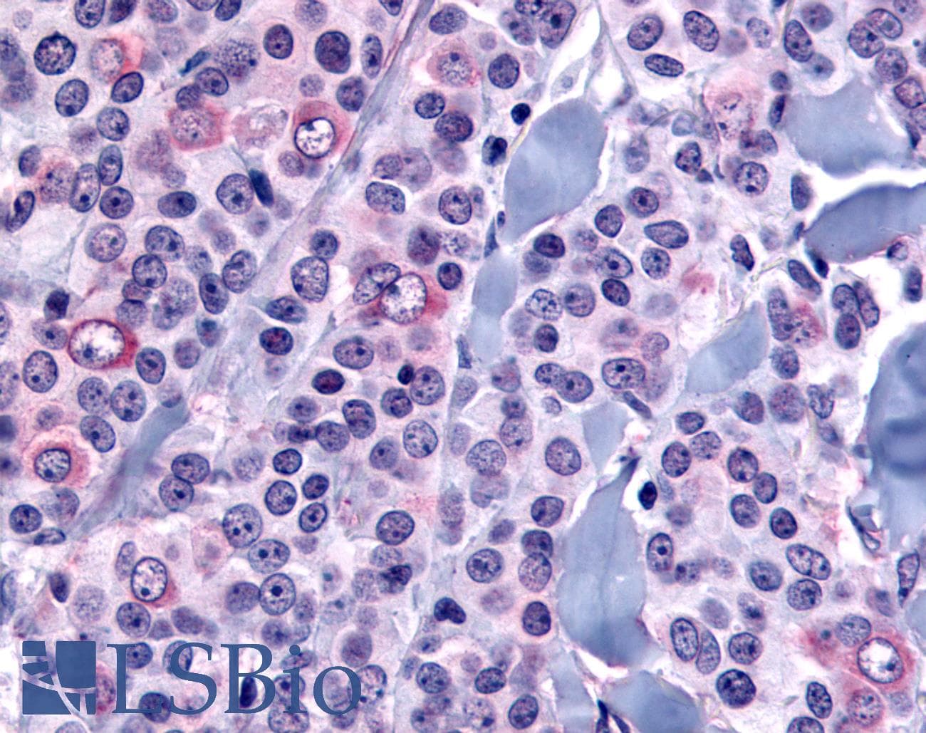 IHC-plus™ NANP Antibody (Internal)