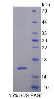 Mouse SPECC1 / CYTSB Protein (Recombinant His-T7)