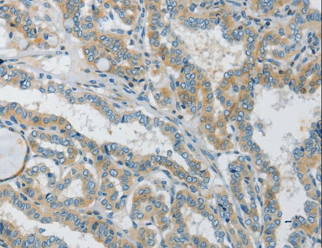 Polyclonal Rabbit anti-Human GJC1 / CX45 / Connexin 45 Antibody (IHC)