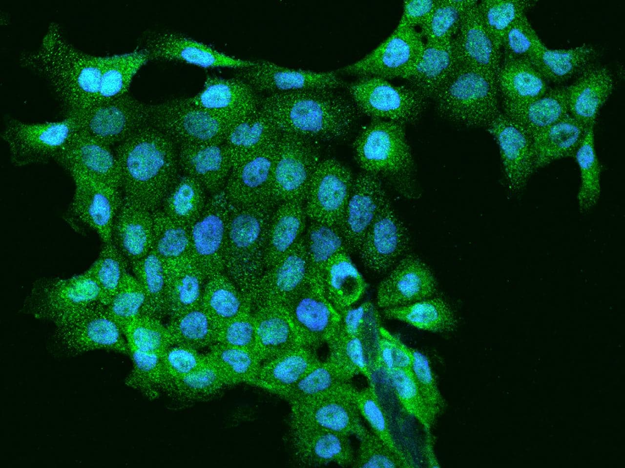 RNF41 Antibody