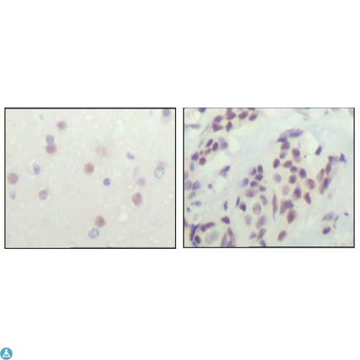 N-CoR / NCOR1 Antibody