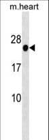 IHC-plus™ HOXB7 Antibody (aa93-121)