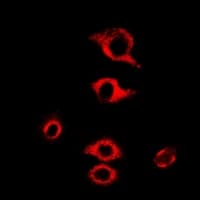 RPL9 / Ribosomal Protein L9 Antibody