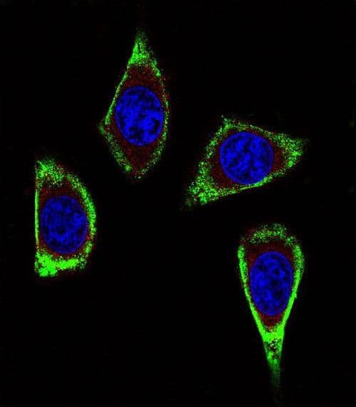 RET Antibody