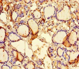 KLHL38 Antibody