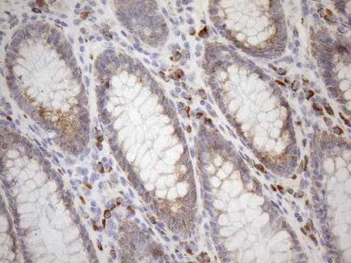 Monoclonal Mouse anti-Human NT5E / eNT / CD73 Antibody (clone OTI1G2, aa119-232, IHC, WB)