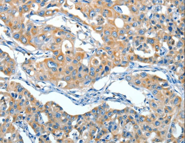 Polyclonal Rabbit anti-Human Alpha-1-Antichymotrypsin Antibody (IHC)