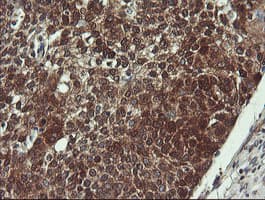 Monoclonal Mouse anti-Human VBP1 Antibody (clone OTI2C2, IHC, WB)