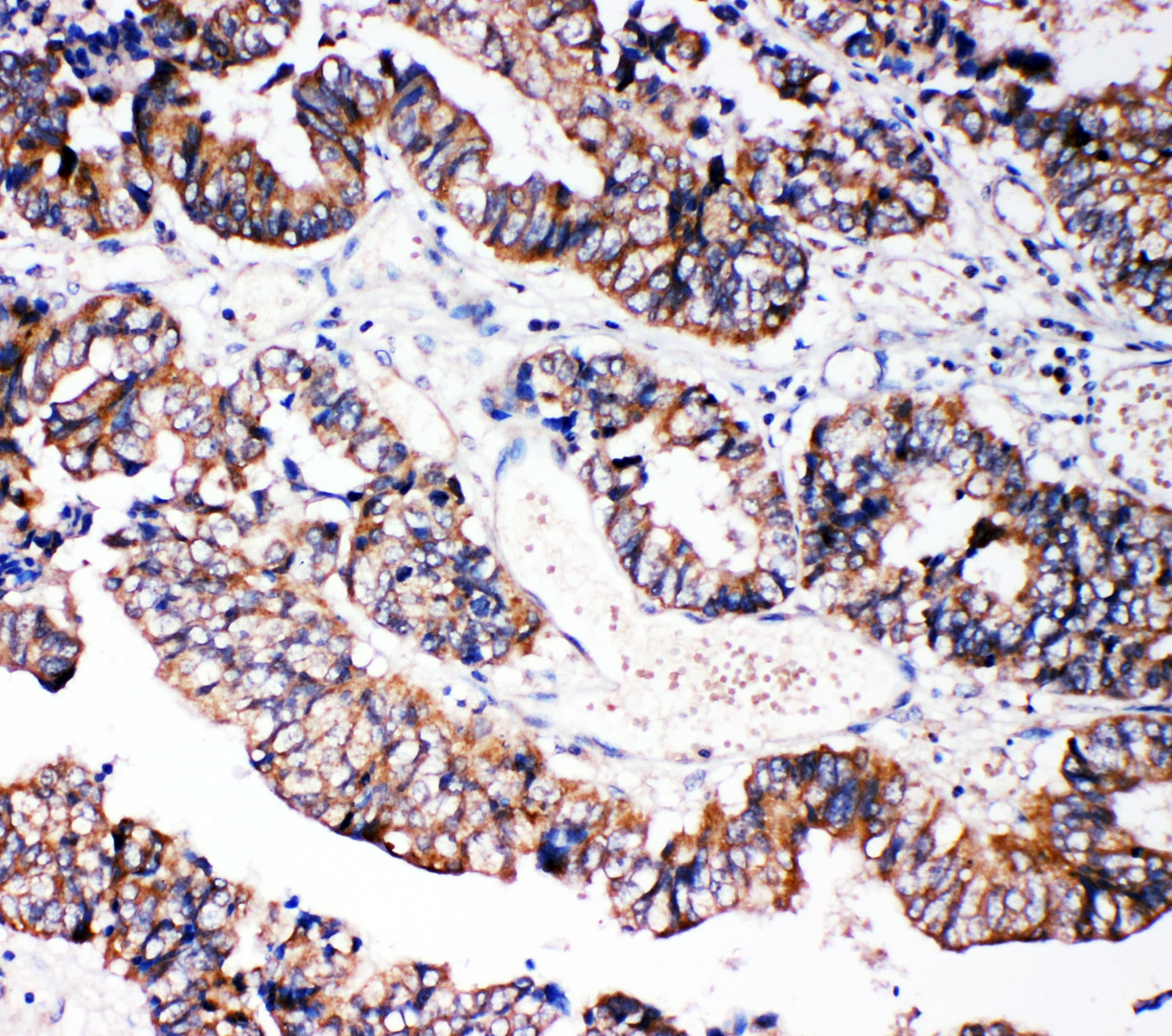 CASP3 / Caspase 3 Antibody (C-Terminus)