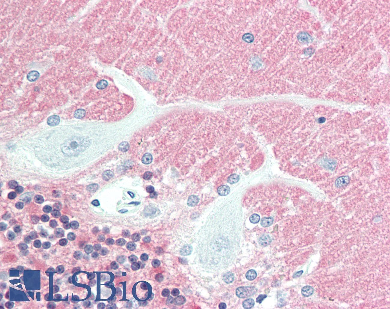 IHC-plus™ Monoclonal Mouse anti-Human VILIP / VSNL1 Antibody (clone 2D11, IHC, IF, WB)