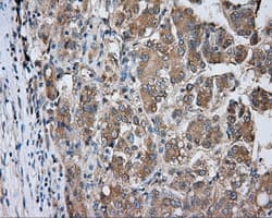 PRKAR2A Antibody (clone OTI1A7, Carrier-free)