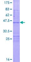 Human LIAS / LIP1 Protein (Recombinant GST)