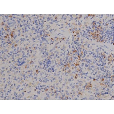 STAT6 Antibody (phospho-Tyr641)