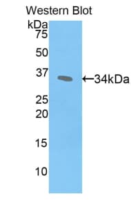 CREBBP / CREB Binding Protein Antibody (aa2141-2442, Biotin)