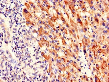 PIM3 / PIM-3 Antibody