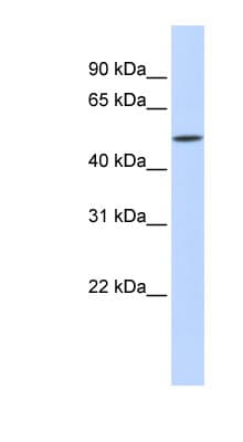 ISG54 / IFIT2 Antibody (N-Terminus)