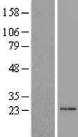 TM2D1 / BBP Protein (Over-Expression Lysate Myc-DDK (Flag))