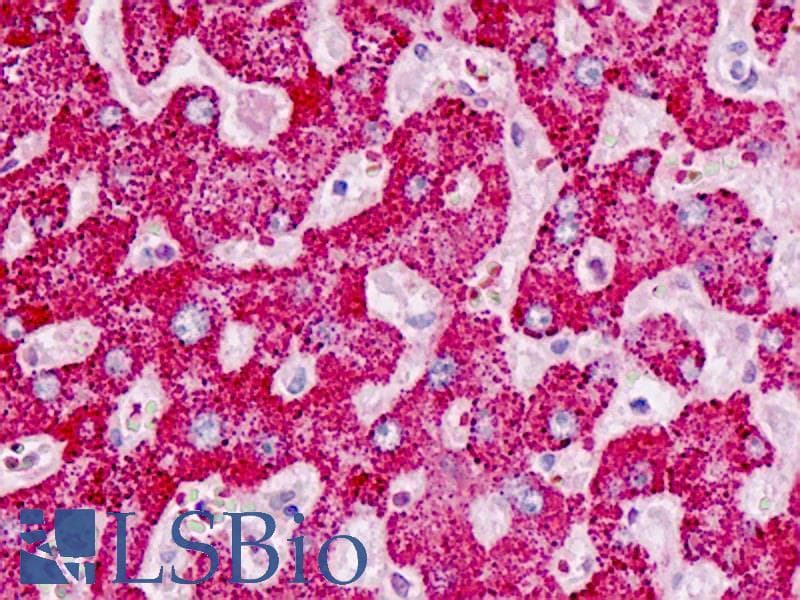 IHC-plus™ DAAM2 Antibody (aa68-97)