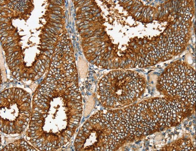 RAB25 Antibody