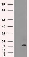 CRYAB / Alpha B Crystallin Antibody (clone OTI6A9)
