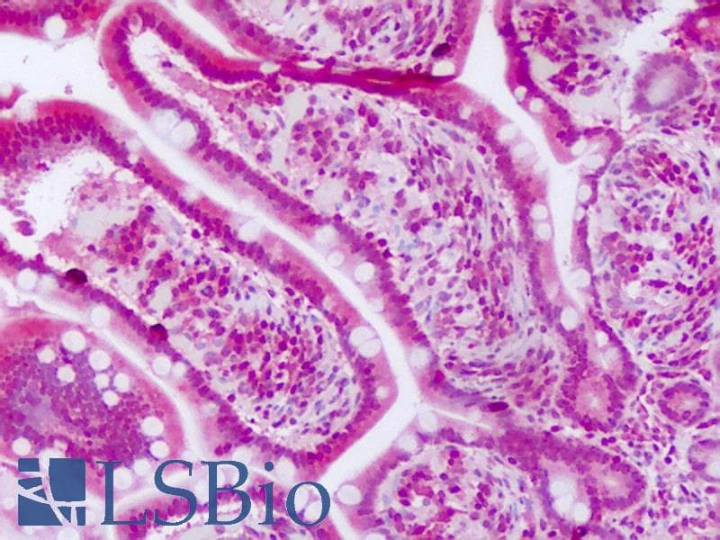 Polyclonal Rabbit anti-Human GSDMA Antibody (aa223-272, IHC, WB)