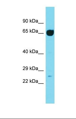 Polyclonal Rabbit anti-Rat IFT74 / CCDC2 Antibody (aa221-270, WB)
