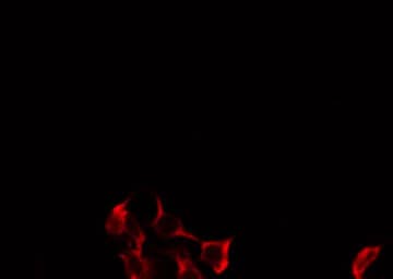 Polyclonal Rabbit anti-Human CYP27 / CYP27A1 Antibody (IF, WB)