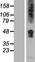 SLC36A1 Protein (Over-Expression Lysate Myc-DDK (Flag))