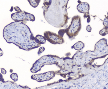 PRKCB / PKC-Beta Antibody