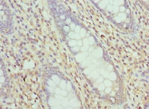 Polyclonal Rabbit anti-Human LIMS1 / PINCH Antibody (IHC, IF)