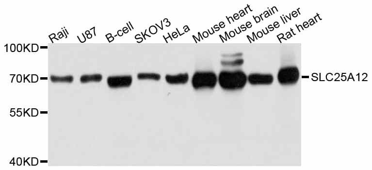 SLC25A12 / ARALAR Antibody