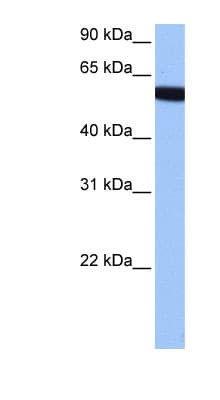 Polyclonal Rabbit anti-Human ZNF891 Antibody (aa282-331, WB)