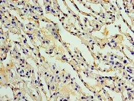 Polyclonal Rabbit anti-Human AKAP8L Antibody (aa1-240, IHC)